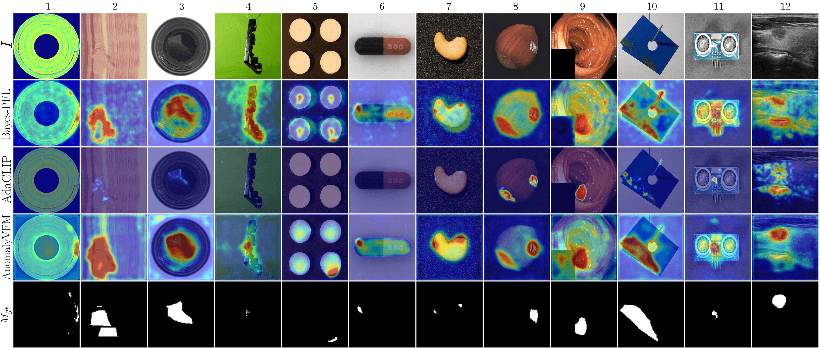 Transforming VFMs into Zero-Shot Anomaly Detectors